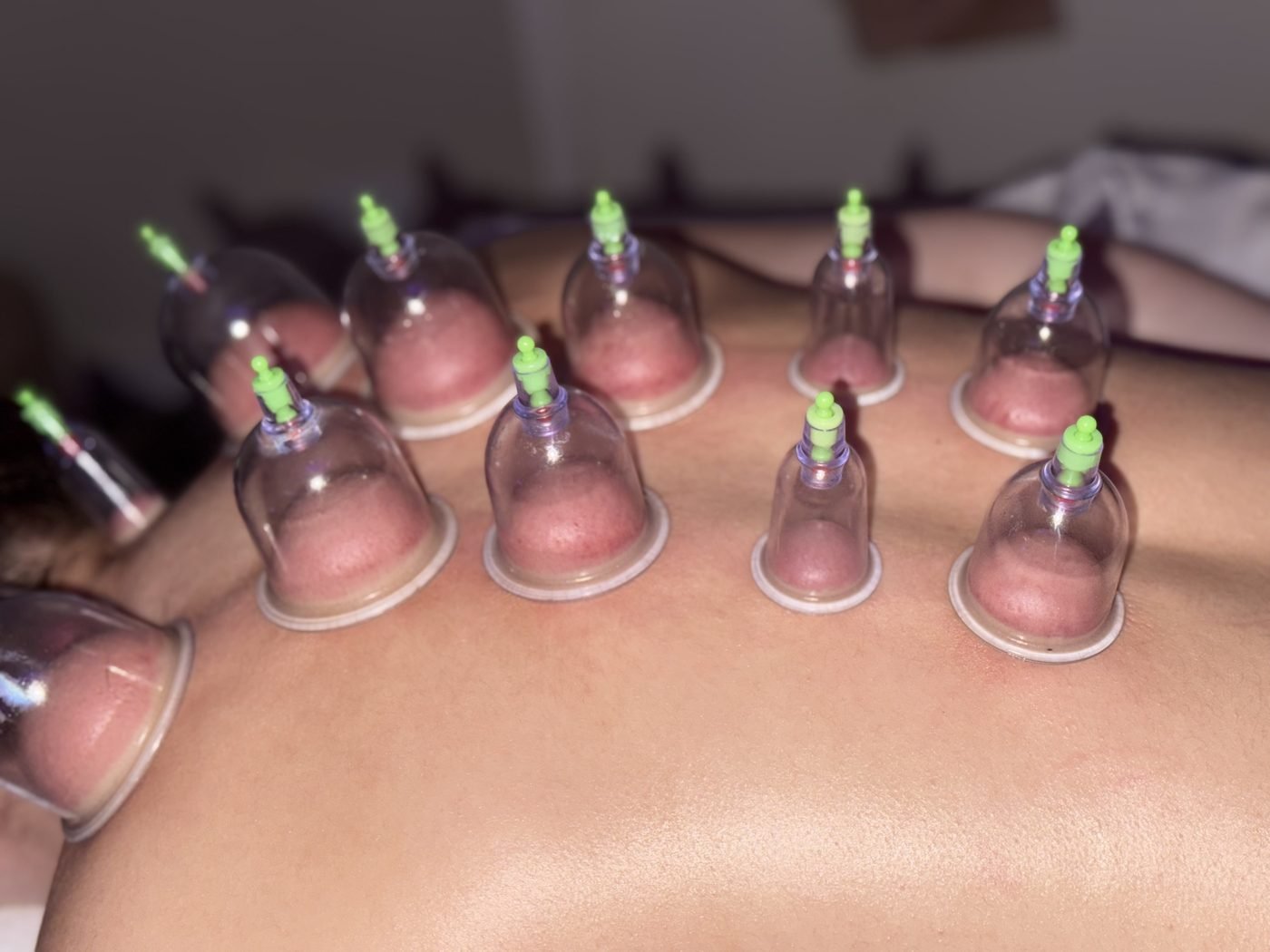 Protocolo corporal com ventosas na Laviance