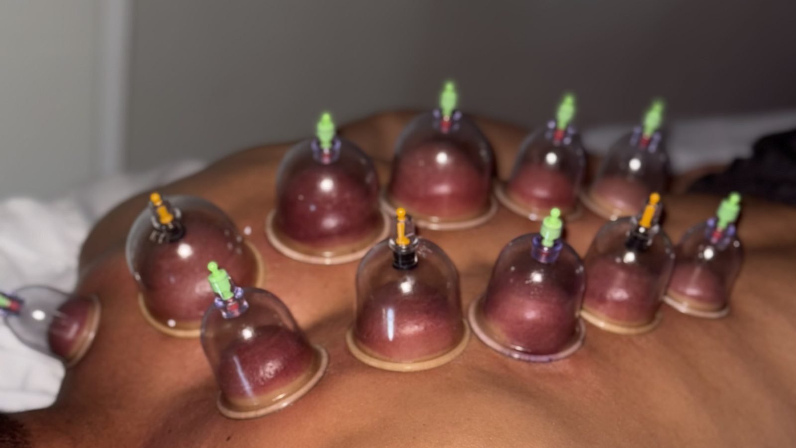 Protocolo corporal com ventosas na Laviance